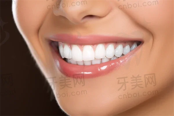 广州禾美口腔门诊部牙周治疗现价仅需1500元起，原价2000元起，优惠不容错过！