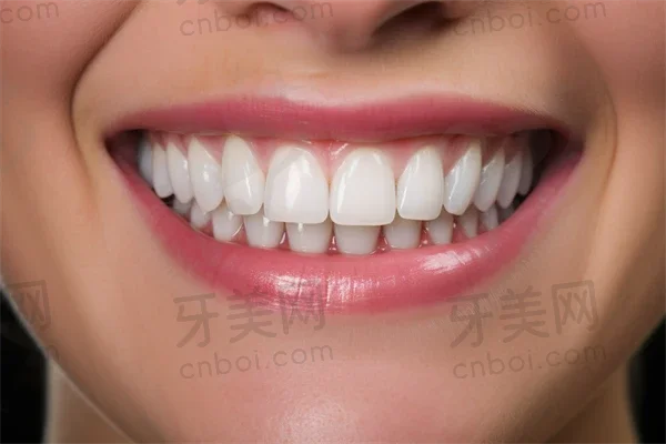 在济南龙腾口腔诊所体验牙齿矫正：专業服务与显著结果的良好融合，让我重拾自信笑容。