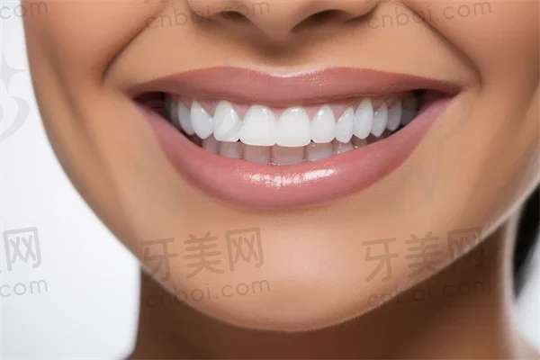 分享在北京贝杰口腔门诊部进行牙齿美白项目的全过程与结果，揭示重拾自信笑容的秘密！