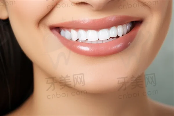我在上海正丰口腔门诊部的烤瓷牙体验全记录：从初步咨询到终治疗的详细过程分享。