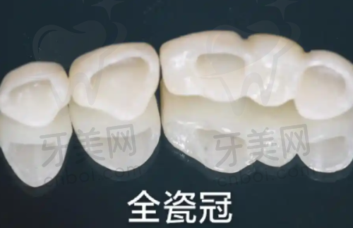 北京佳美口腔优势体现