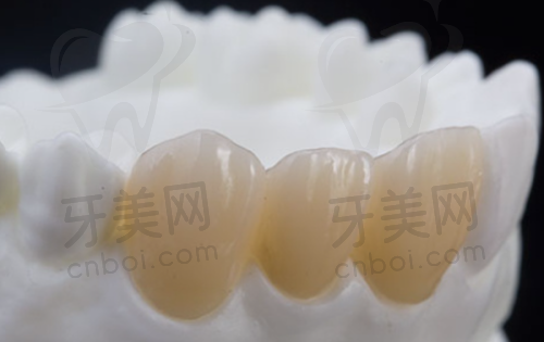 总结