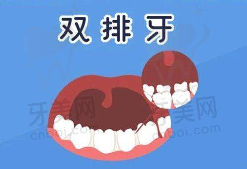 总结