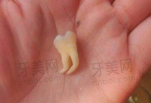 上海慧博口腔门诊部2025年价格表