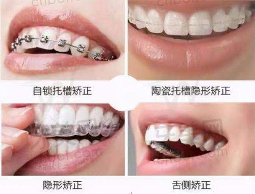 惠州丛林口腔医院靠谱吗？连锁正规设备先进，硕博医师亲诊，种植牙优惠多收费透明