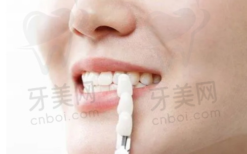 正畸种植项目的特点