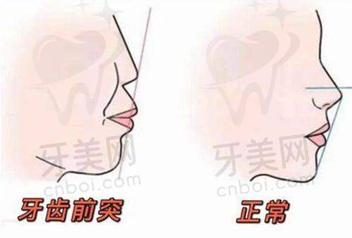 口腔项目科普