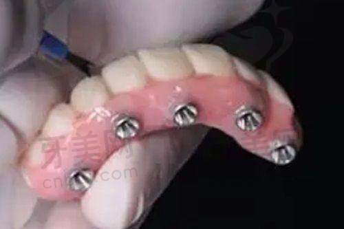 南昌维乐口腔医院的潜在优势